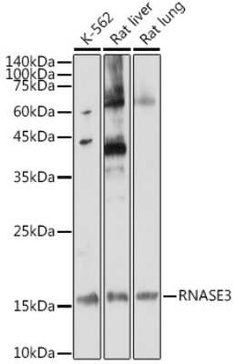 Western Blot: RNASE3 AntibodyAzide and BSA Free [NBP2-94405]